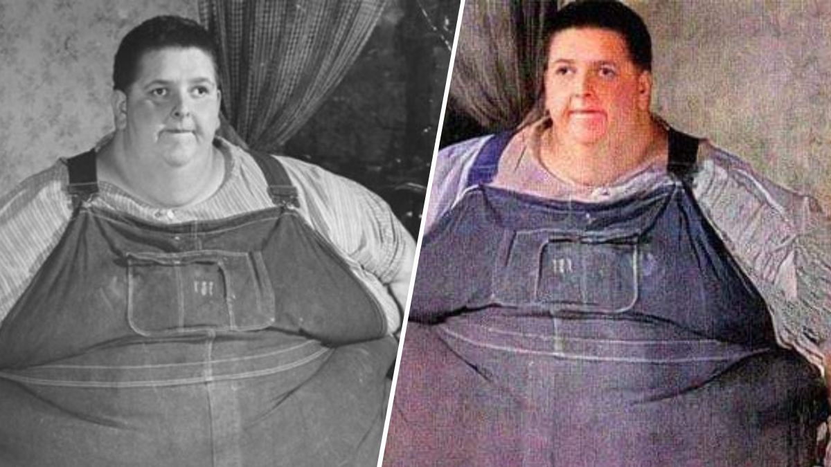 O Caso Mais Extremo de Obesidade da História: A Impressionante Vida de Jon Brower Minnoch