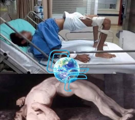 A DOENÇA REAL QUE A HISTÓRIA CONFUNDIU COM POSSESSÃO DEMONÍACA!